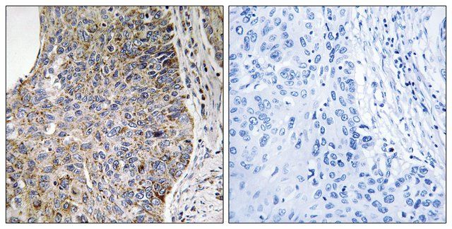 Anti-NEK7 antibody produced in rabbit