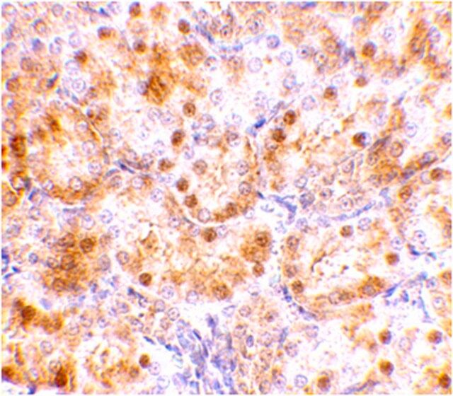 Anti-NENF Antibody