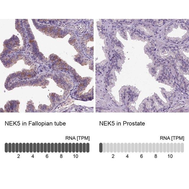 Anti-NEK5 antibody produced in rabbit