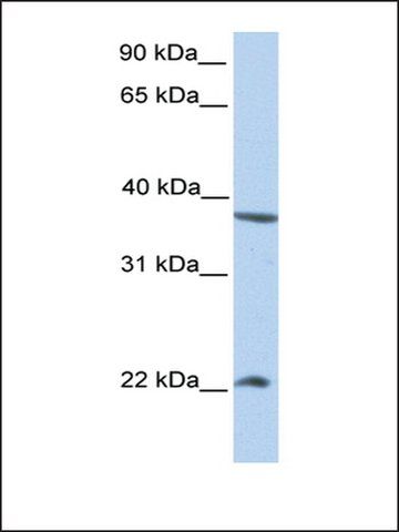 Anti-NEK7 antibody produced in rabbit