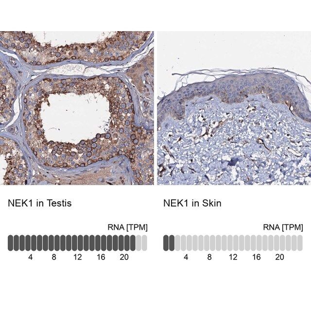 Anti-NEK1 antibody produced in rabbit