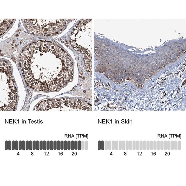 Anti-NEK1 antibody produced in rabbit