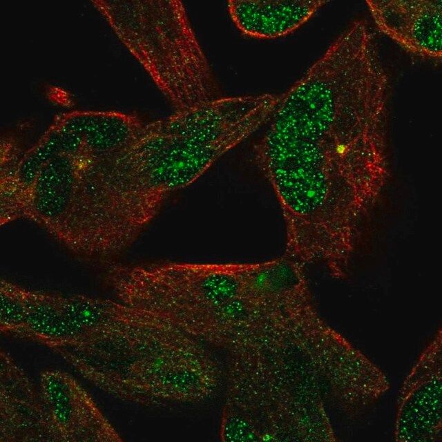 Anti-NEK2 antibody produced in rabbit