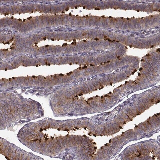 Anti-MTR antibody produced in rabbit