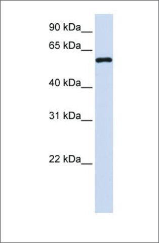 Anti-MTX1 antibody produced in rabbit