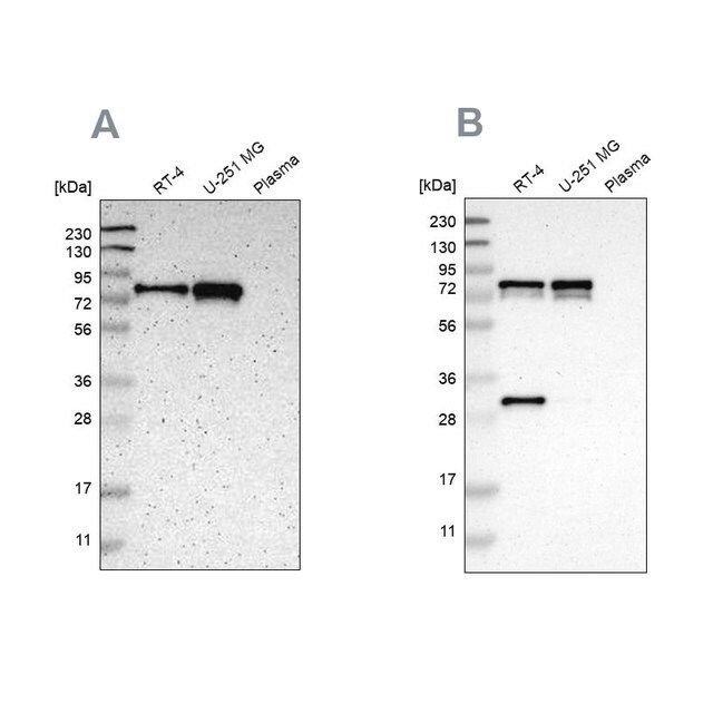 Anti-MTDH antibody produced in rabbit