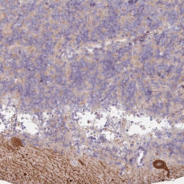 Anti-MTMR14 antibody produced in rabbit