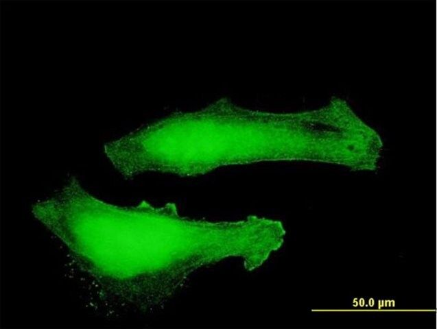 Anti-MTPN antibody produced in mouse