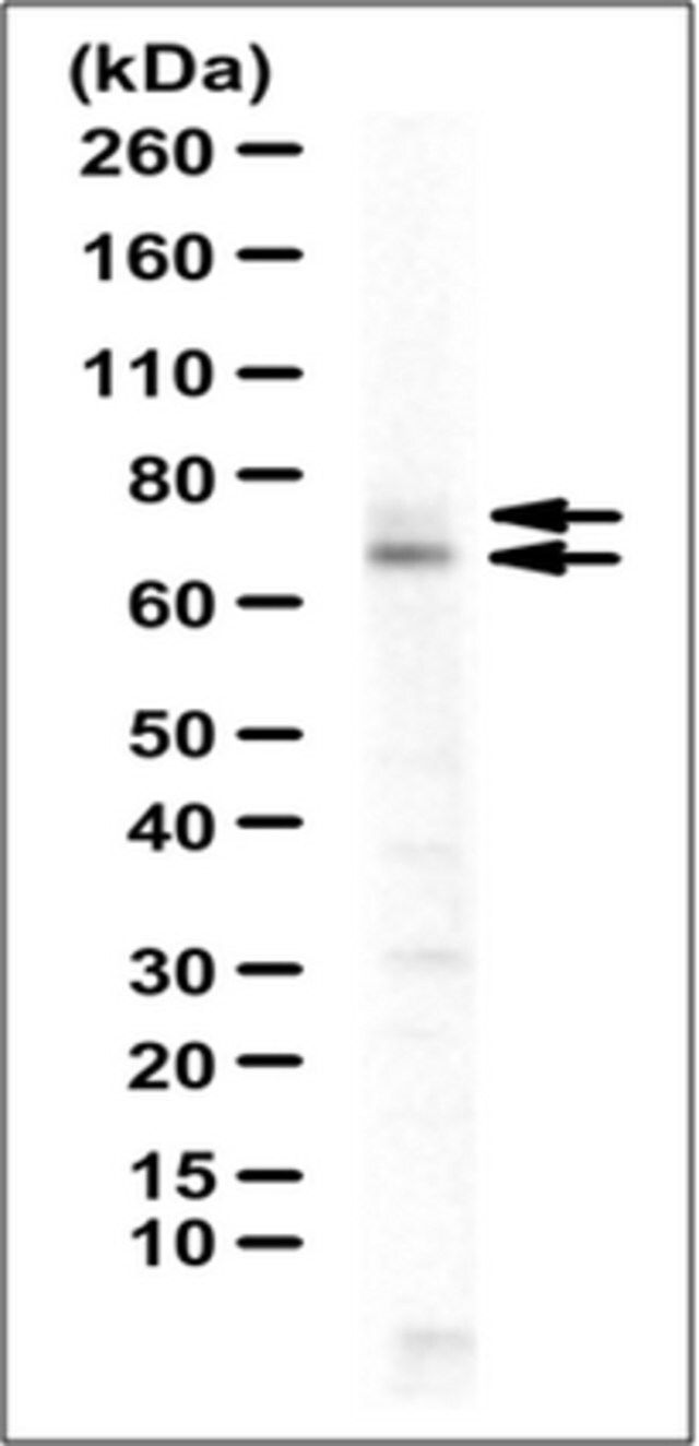 Anti-MTHFR Antibody