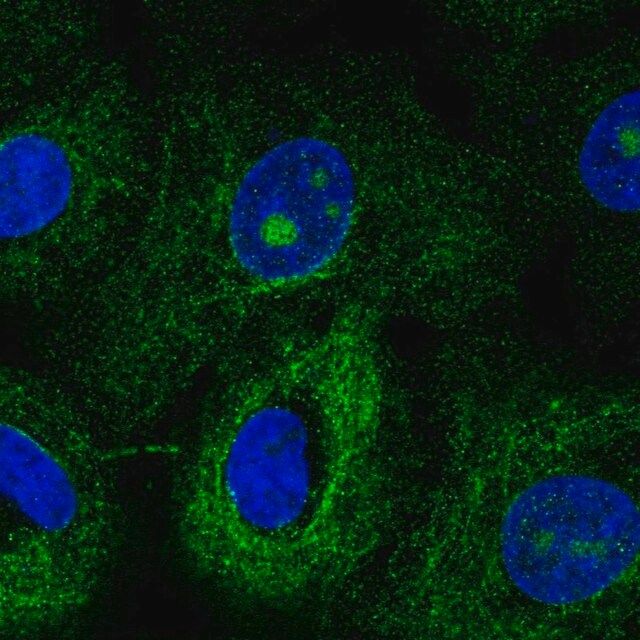 Anti-MTUS1 antibody produced in rabbit