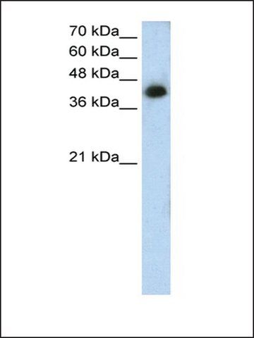 Anti-MTUS1 antibody produced in rabbit