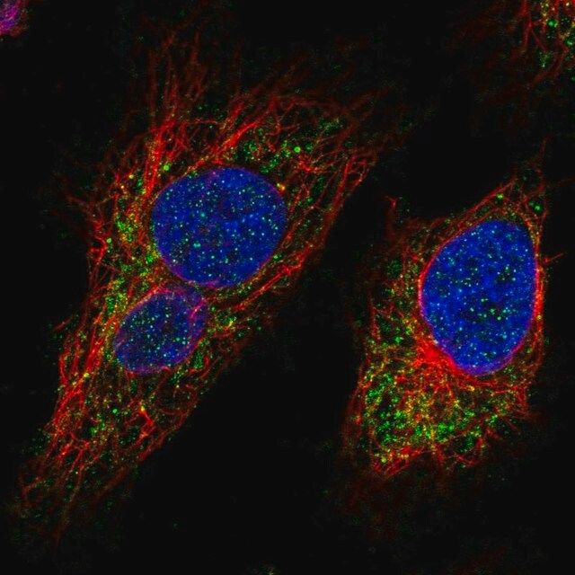 Anti-MTX3 antibody produced in rabbit