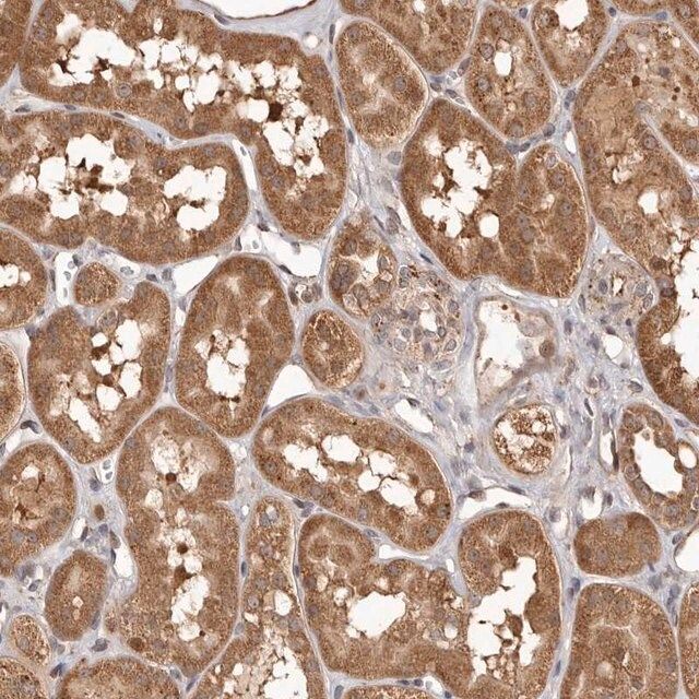 Anti-MTO1 antibody produced in rabbit