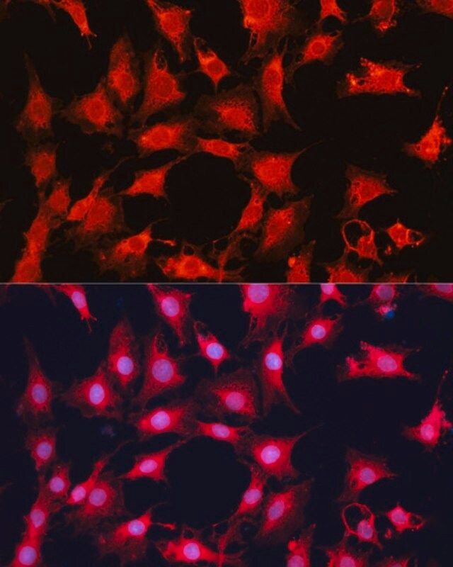 Anti-MTOR antibody produced in rabbit