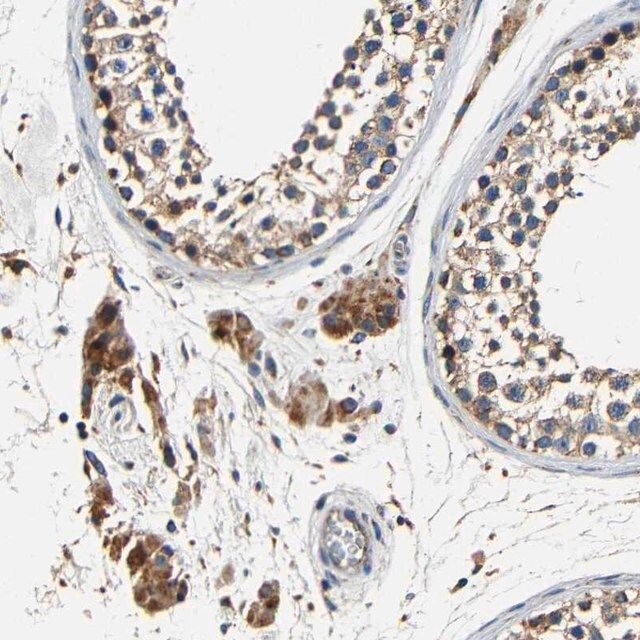 Anti-MTX1 antibody produced in rabbit