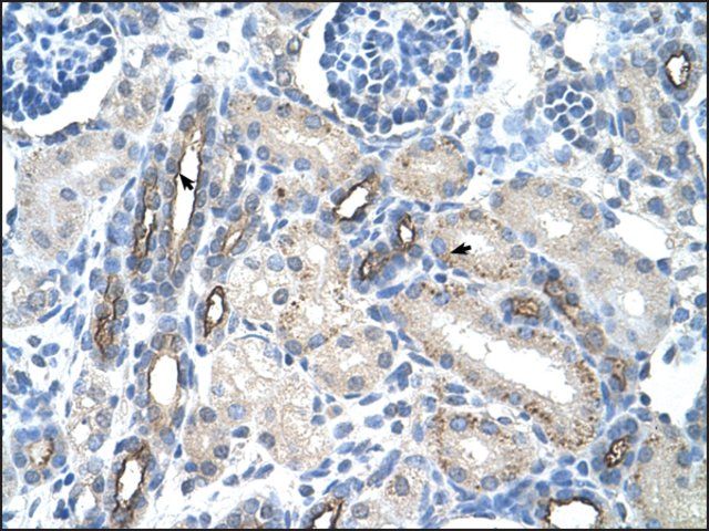 Anti-MUC1 (ab2) antibody produced in rabbit