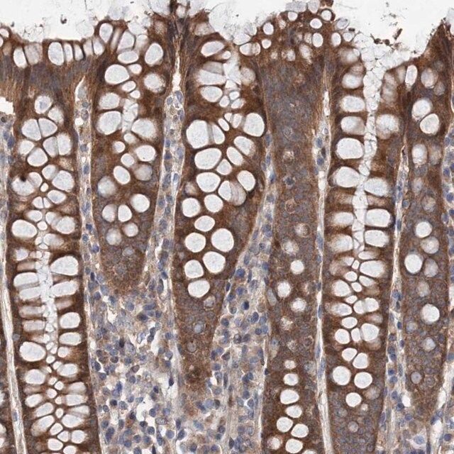 Anti-NAA25 antibody produced in rabbit