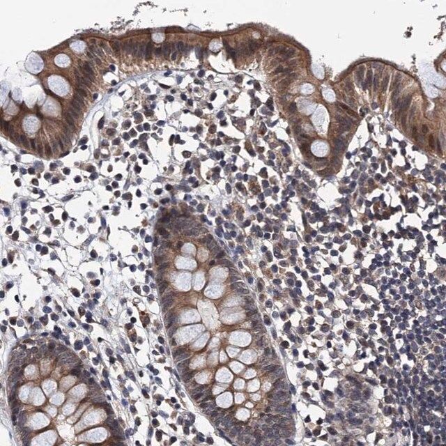 Anti-NAA16 antibody produced in rabbit