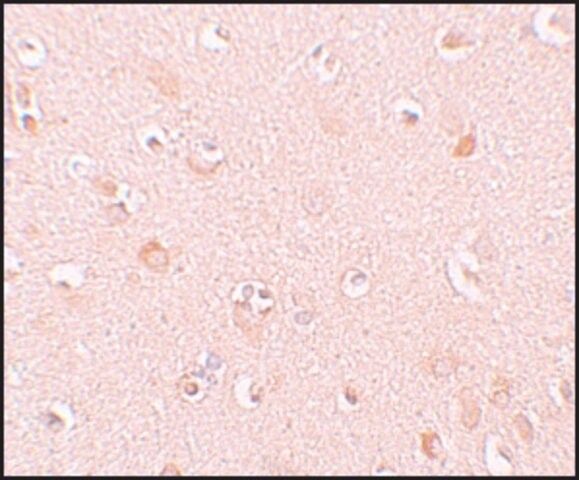 Anti-NALP5 antibody produced in rabbit