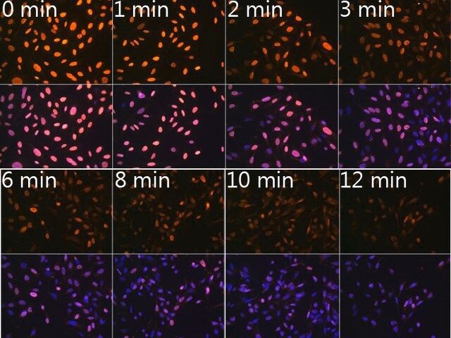 Anti-N6-methyladenosine / m6A antibody produced in rabbit