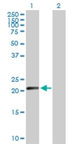 Anti-N6AMT1 antibody produced in rabbit