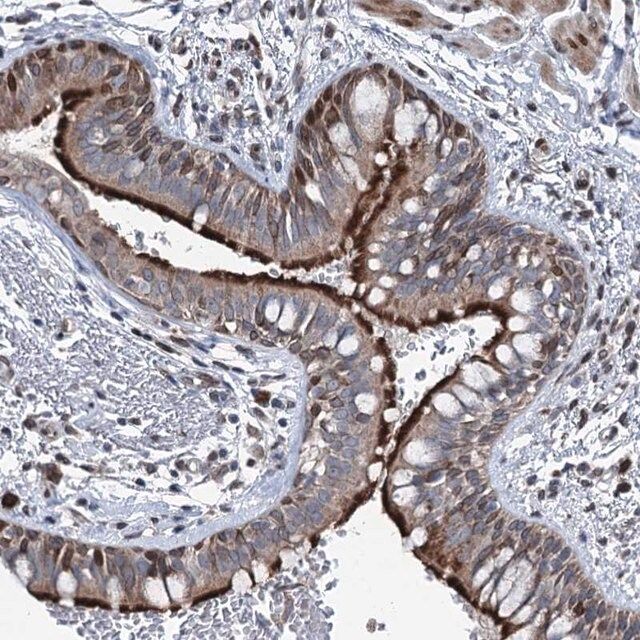 Anti-MRPL14 antibody produced in rabbit