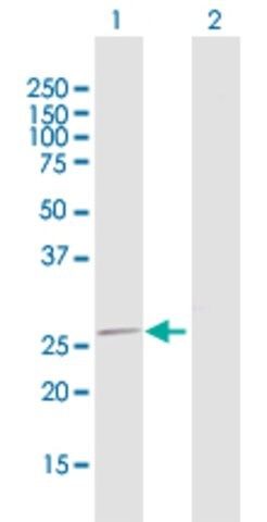 Anti-MRPL16 antibody produced in rabbit