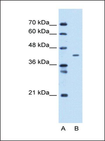 Anti-MTCH1 antibody produced in rabbit