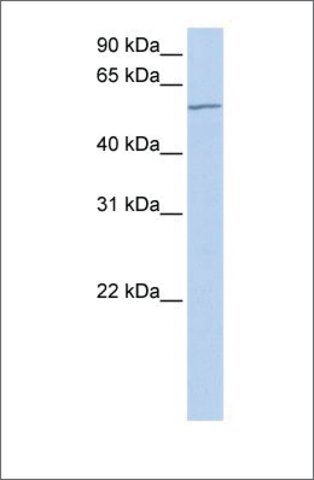 Anti-MTA3 antibody produced in rabbit