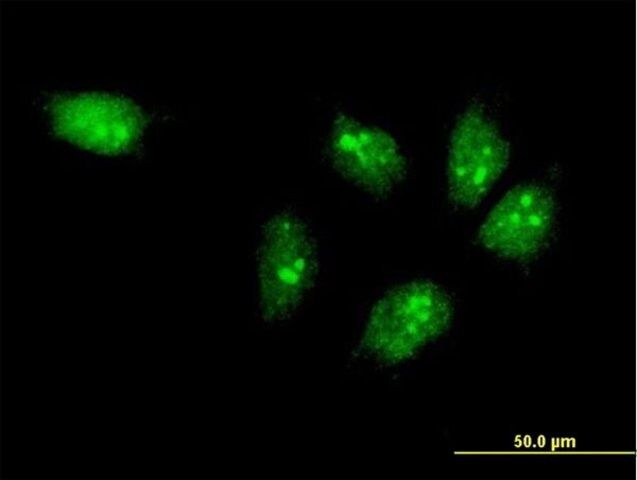 ANTI-MTA3 antibody produced in mouse