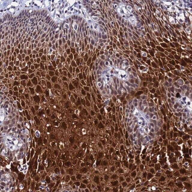 Anti-MTCL1 antibody produced in rabbit