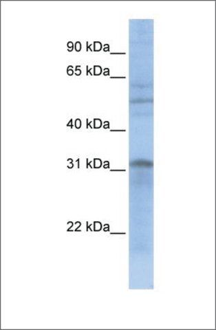 Anti-MTCH2 (ab2) antibody produced in rabbit