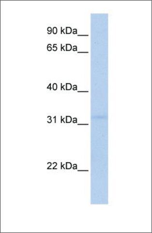 Anti-MTCH2 (ab1) antibody produced in rabbit