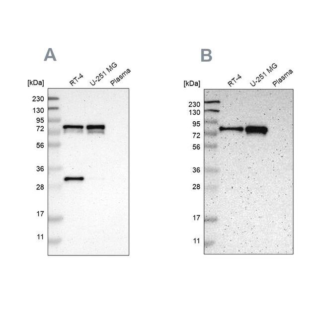 Anti-MTDH antibody produced in rabbit