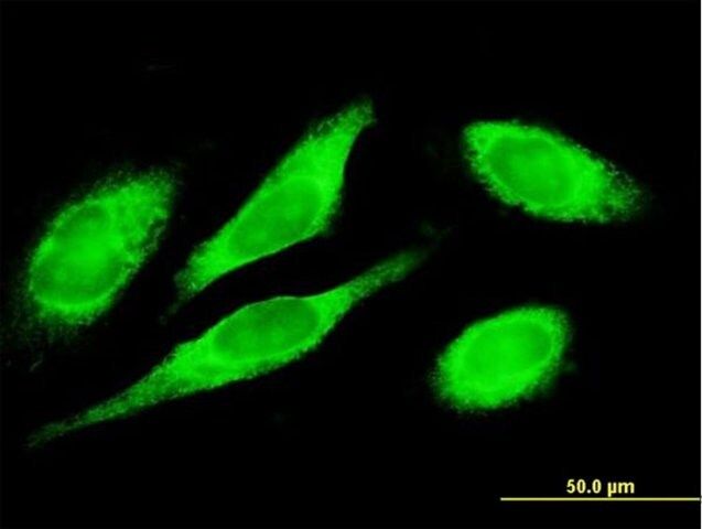 Anti-MTDH antibody produced in mouse