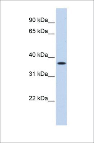 Anti-MTHFD2 (ab3) antibody produced in rabbit