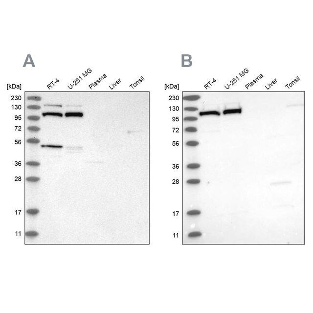 Anti-MTHFD1L antibody produced in rabbit