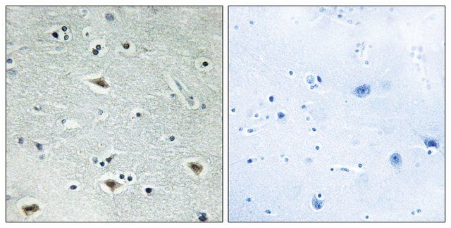 Anti-MTG16 antibody produced in rabbit