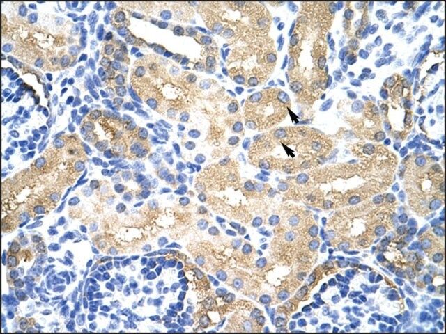 Anti-MTHFSD antibody produced in rabbit