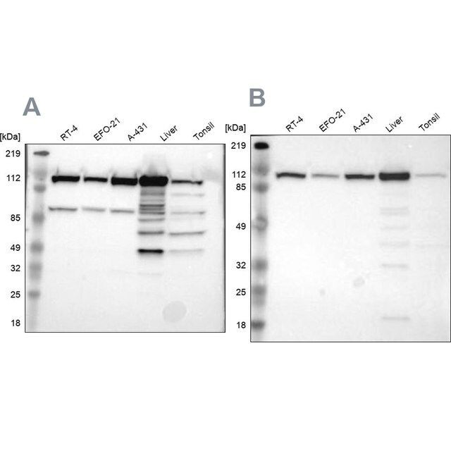 Anti-MTHFD1 antibody produced in rabbit