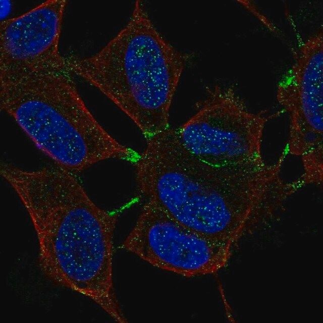 Anti-MTHFR antibody produced in rabbit