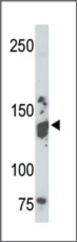 Anti-MTMR5 (C-term) antibody produced in rabbit