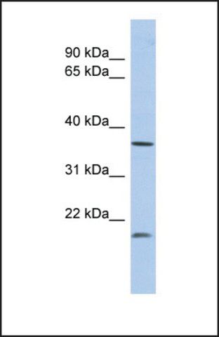 Anti-MTHFD2L antibody produced in rabbit