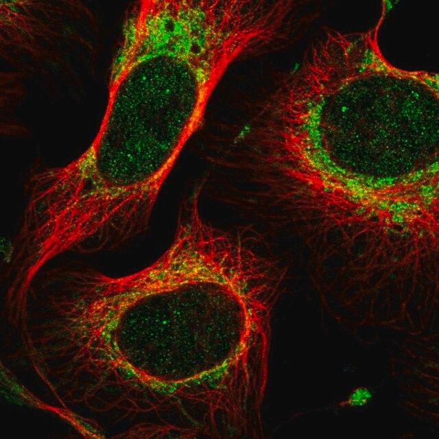 Anti-MTIF2 antibody produced in rabbit