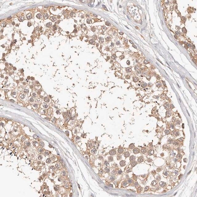 Anti-MTFR2 antibody produced in rabbit