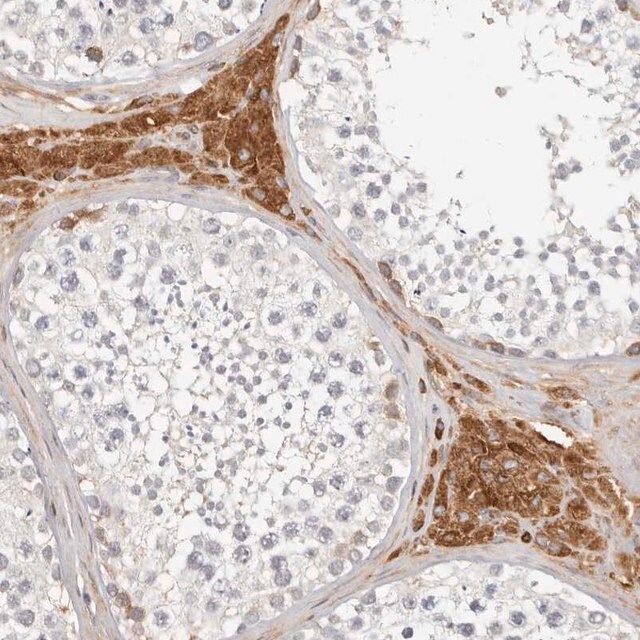 Anti-MTFR2 antibody produced in rabbit