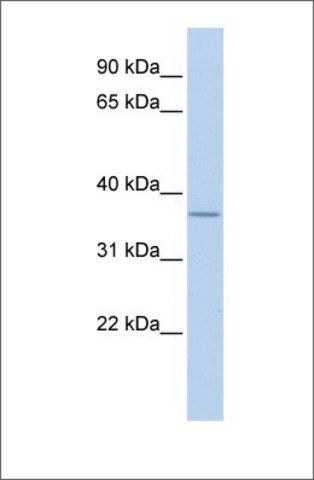 Anti-MTHFD2 (ab2) antibody produced in rabbit