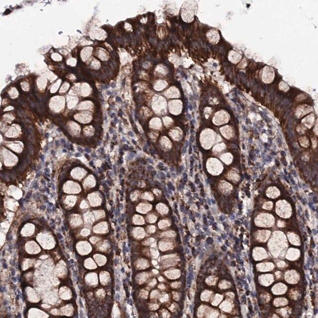 Anti-MTIF3 antibody produced in rabbit