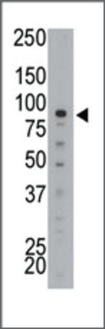 Anti-MTMR2 (N-term) antibody produced in rabbit