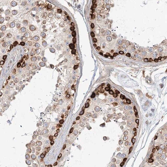 Anti-MTMR3 antibody produced in rabbit